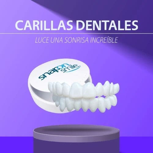 Carillas dentales - Snap On Smile - Vuelve a sonreír con Confianza